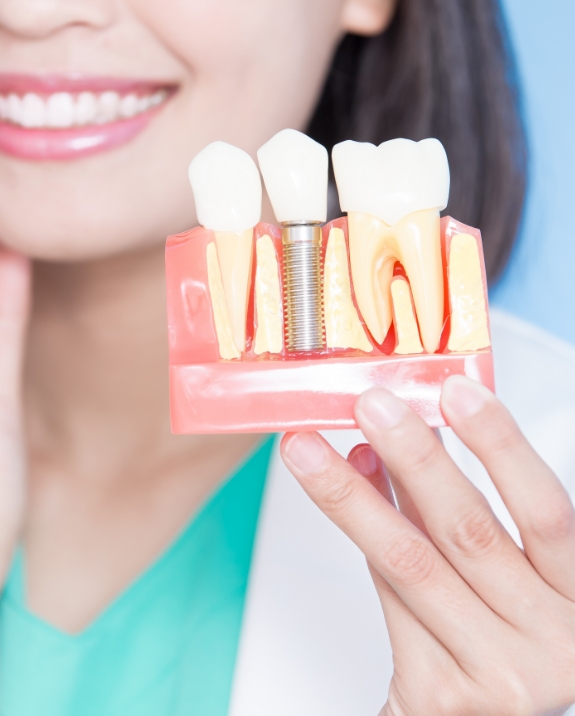 Smiling dentist holding a dental implant model