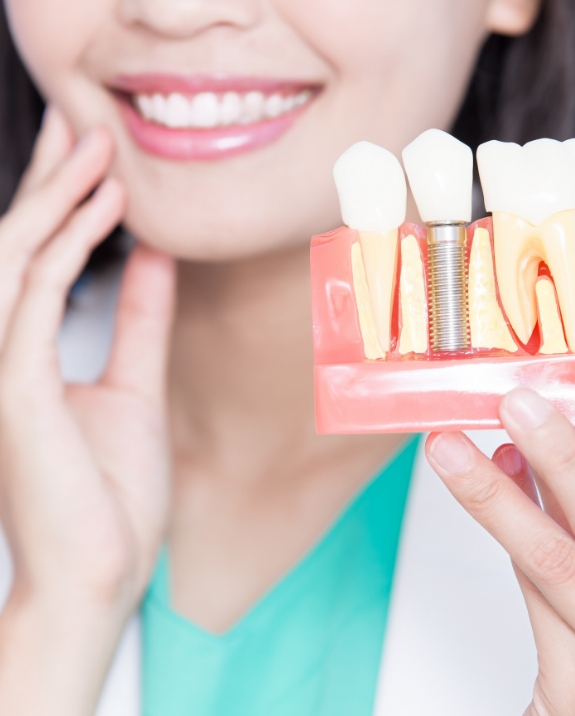 Smiling dentist holding a model of a dental implant