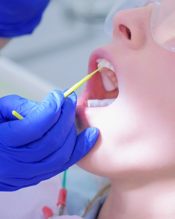 Dental patient having fluoride applied to their teeth