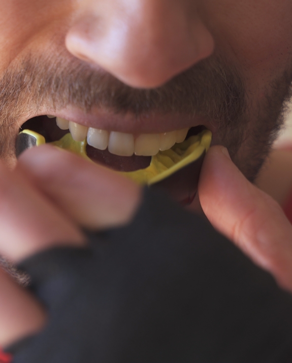 Man placing yellow mouthguard over his teeth