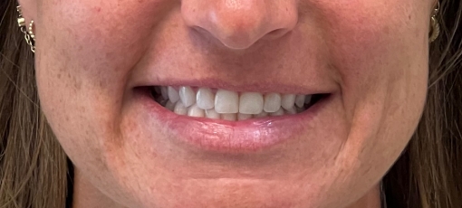 Close up of smiling woman with evenly spaced teeth