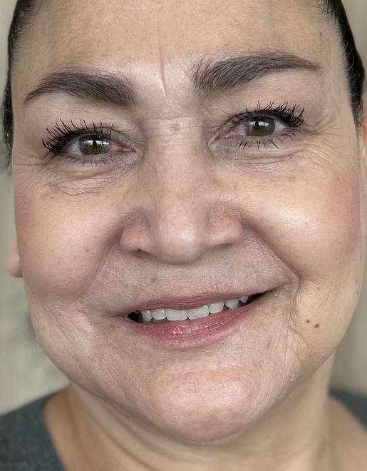 Woman smiling with brighter teeth