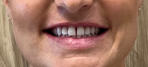 Close up of smiling woman with slightly gapped teeth
