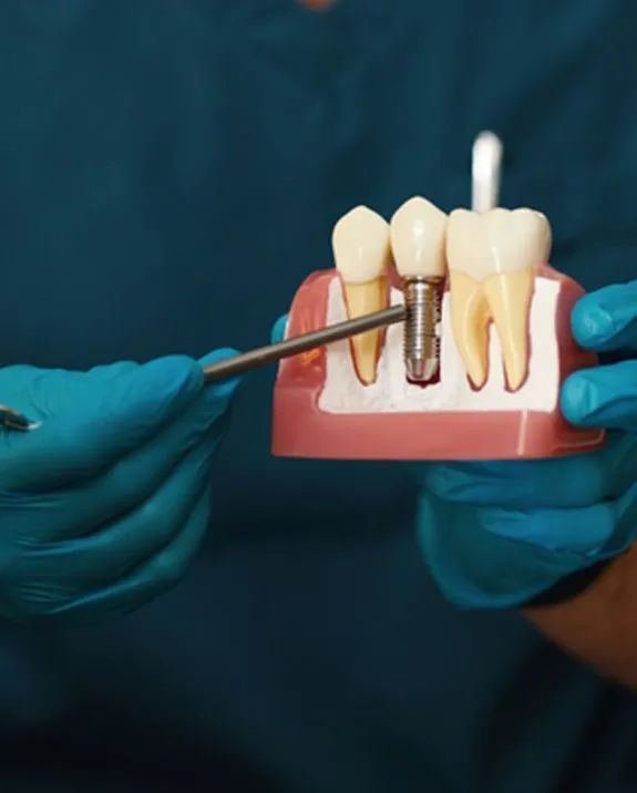 same-day dental implants