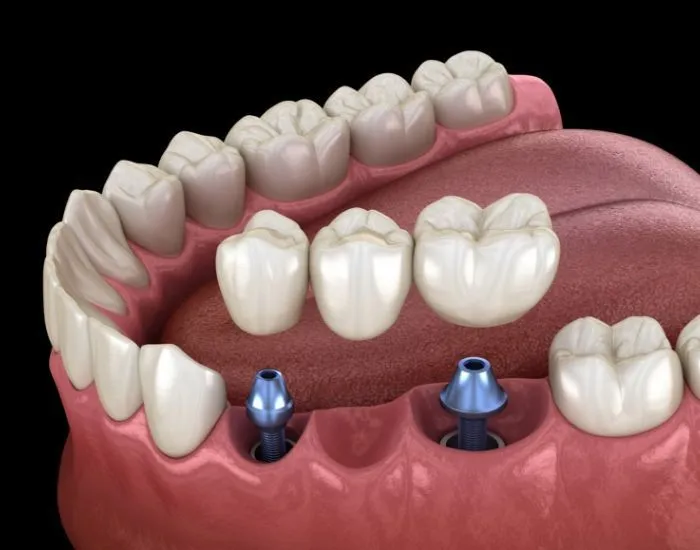 dental care