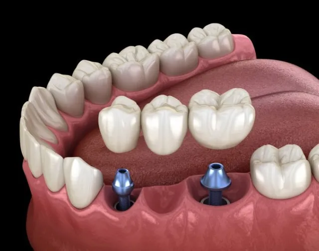 dental care