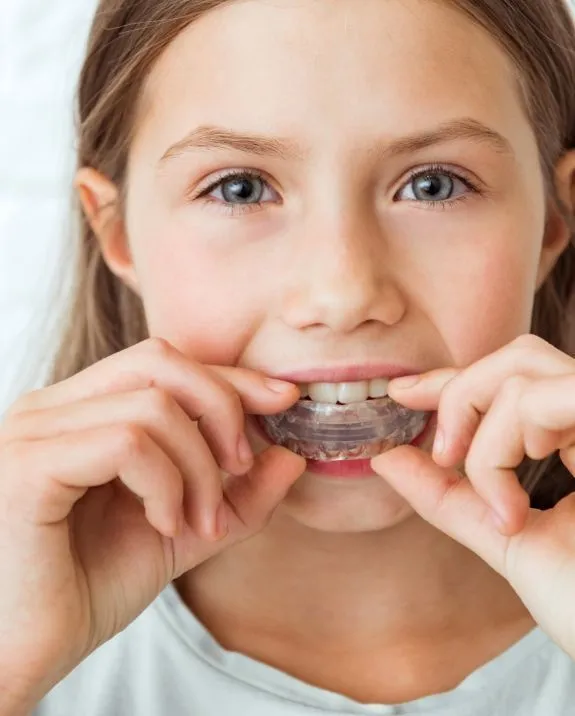 Girl inserting clear aligner in mouth, smiling.