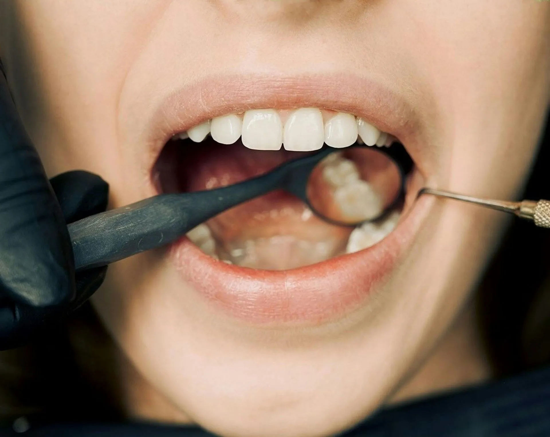 dentistry services Mesa