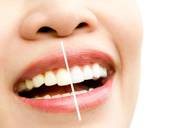 cosmetic dentistry Mesa